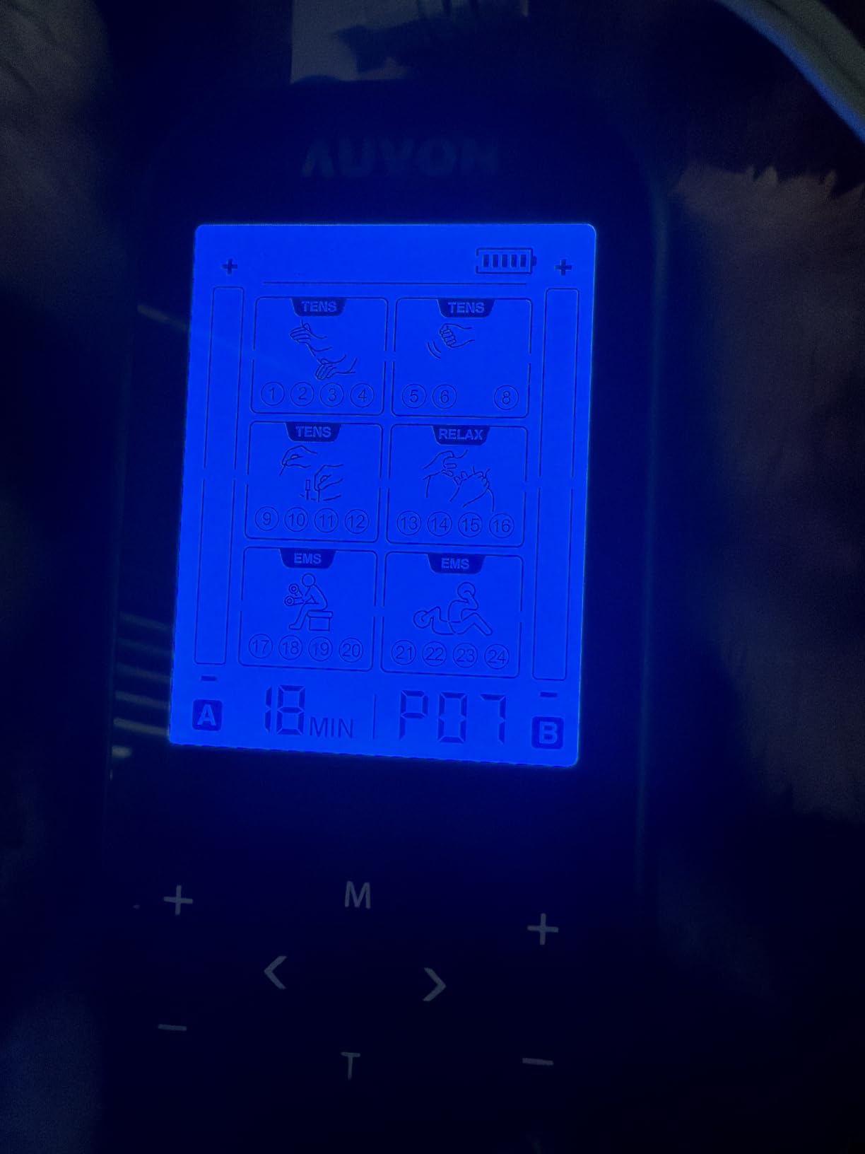 AUVON 3-in-1 TENS Unit Muscle Stimulator, 40 Levels for Gradual Pain Relief customer photo 2