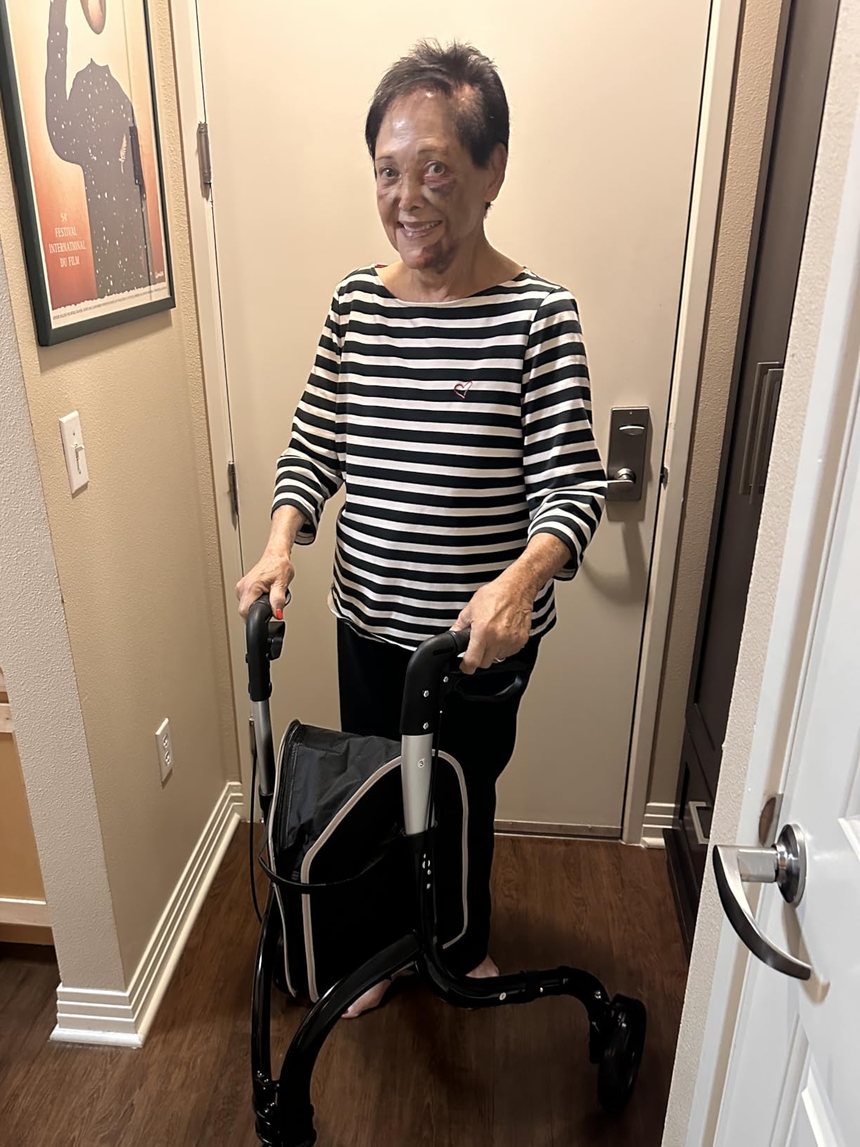 soundfuse Lightweight 3 Wheel Walkers for Seniors, Foldable Aluminum Frame | Weighs only 10.2lbs, Height Adjustable, Removable Storage Bag, Three Wheel Rollator Walker for Indoor and Outdoor Use customer photo 2