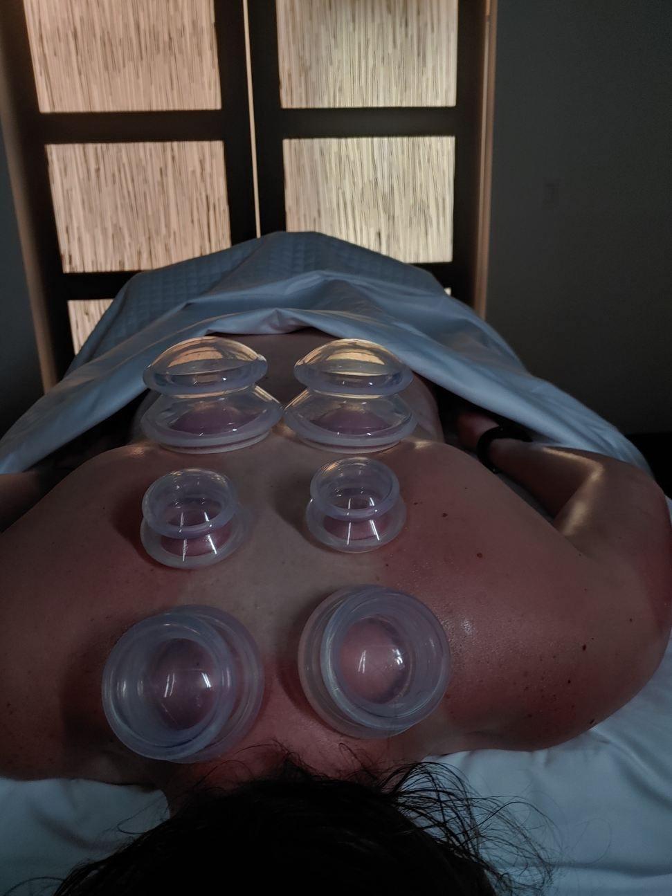 Cupping Warehouse Firm Silicone Cupping Set – Supreme 6 DP, Advanced 6065 customer photo 1