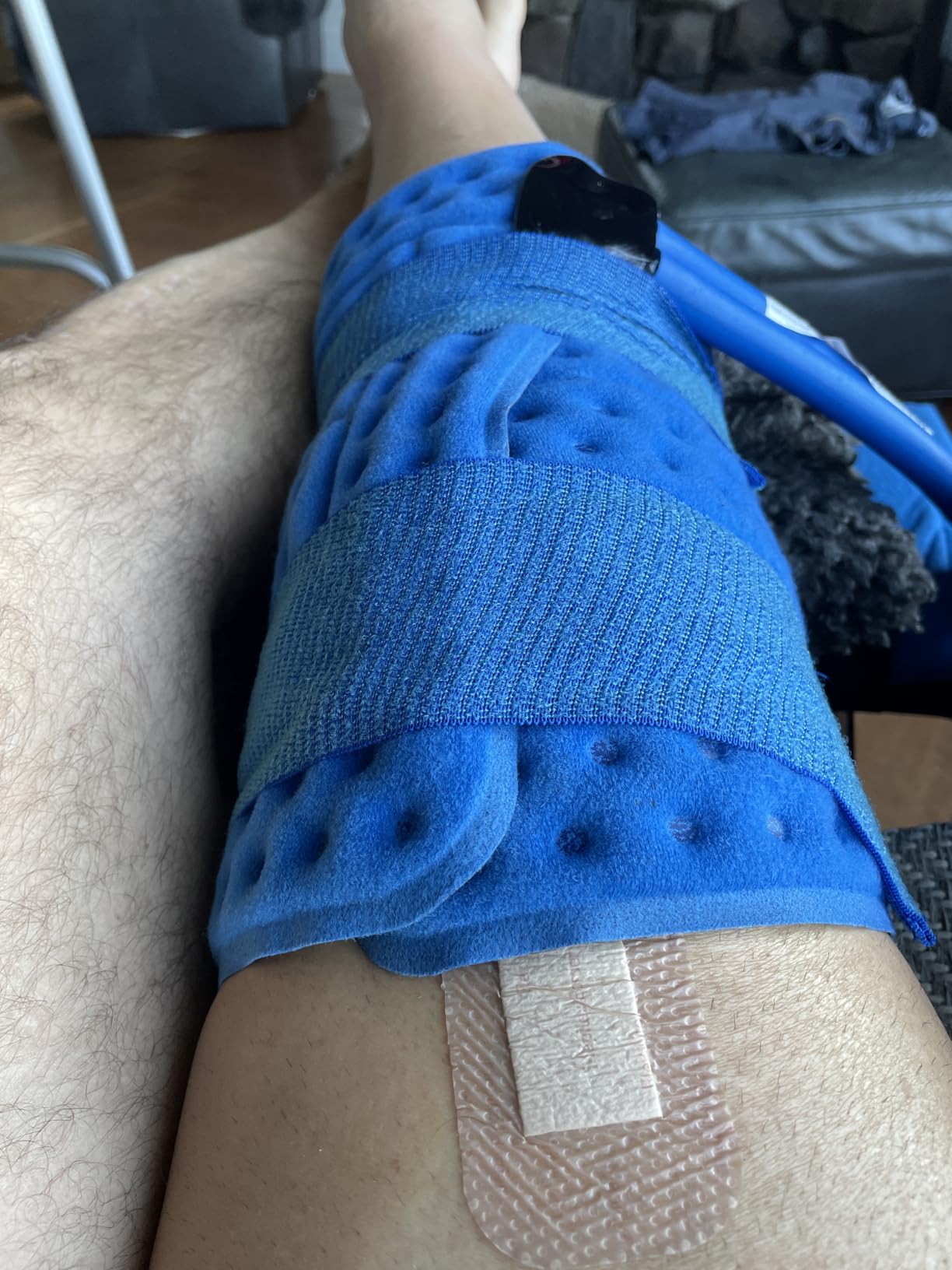 Polar Active Ice 3.0 | 9 QT Cold Therapy Ice Machine | Programmable Timer | Knee & Joint Pad | Cryotherapy Pain Relief System | Ace Bandage Style Compression customer photo 2