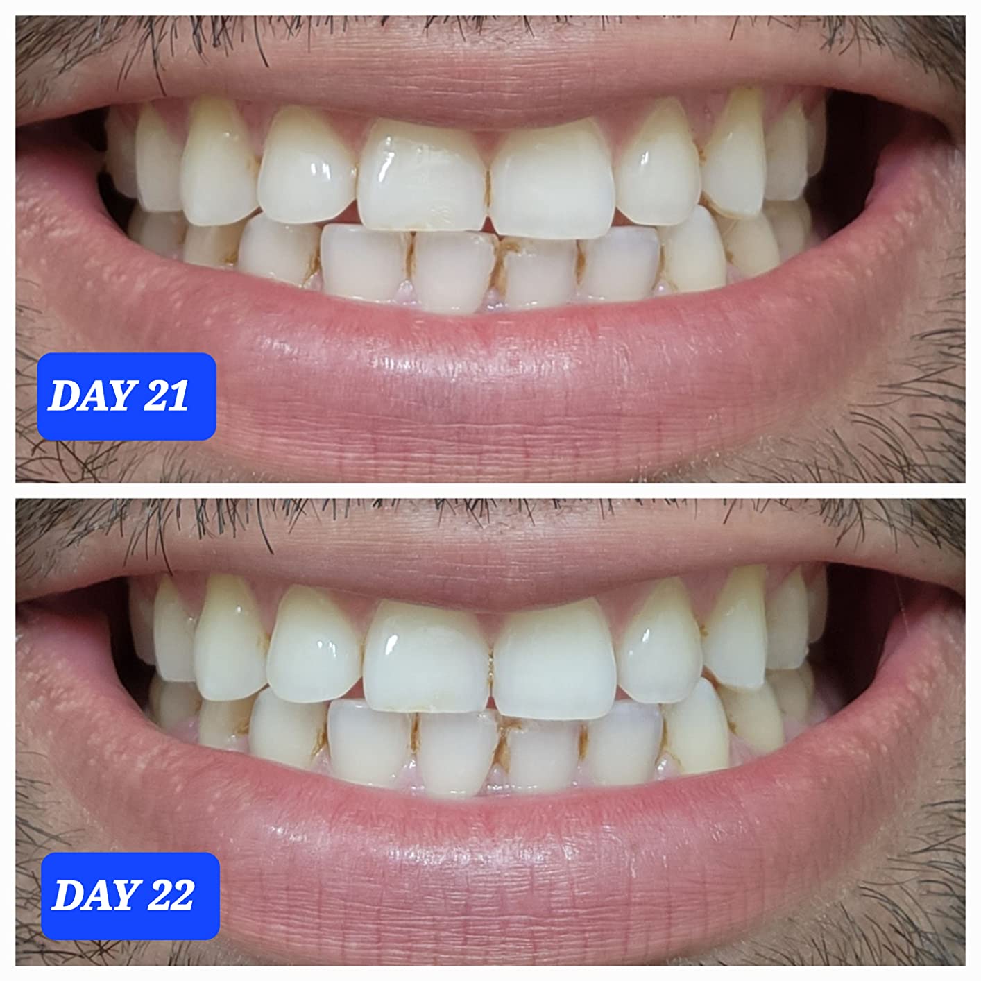 Crest Teeth Whitening Strips, Crest 3D Whitestrips Professional Effects, Enamel Safe Teeth Whitening Kit, 22 Treatments (44 Strips), Professional-Level Whitening, 19 Levels Whiter customer photo 2