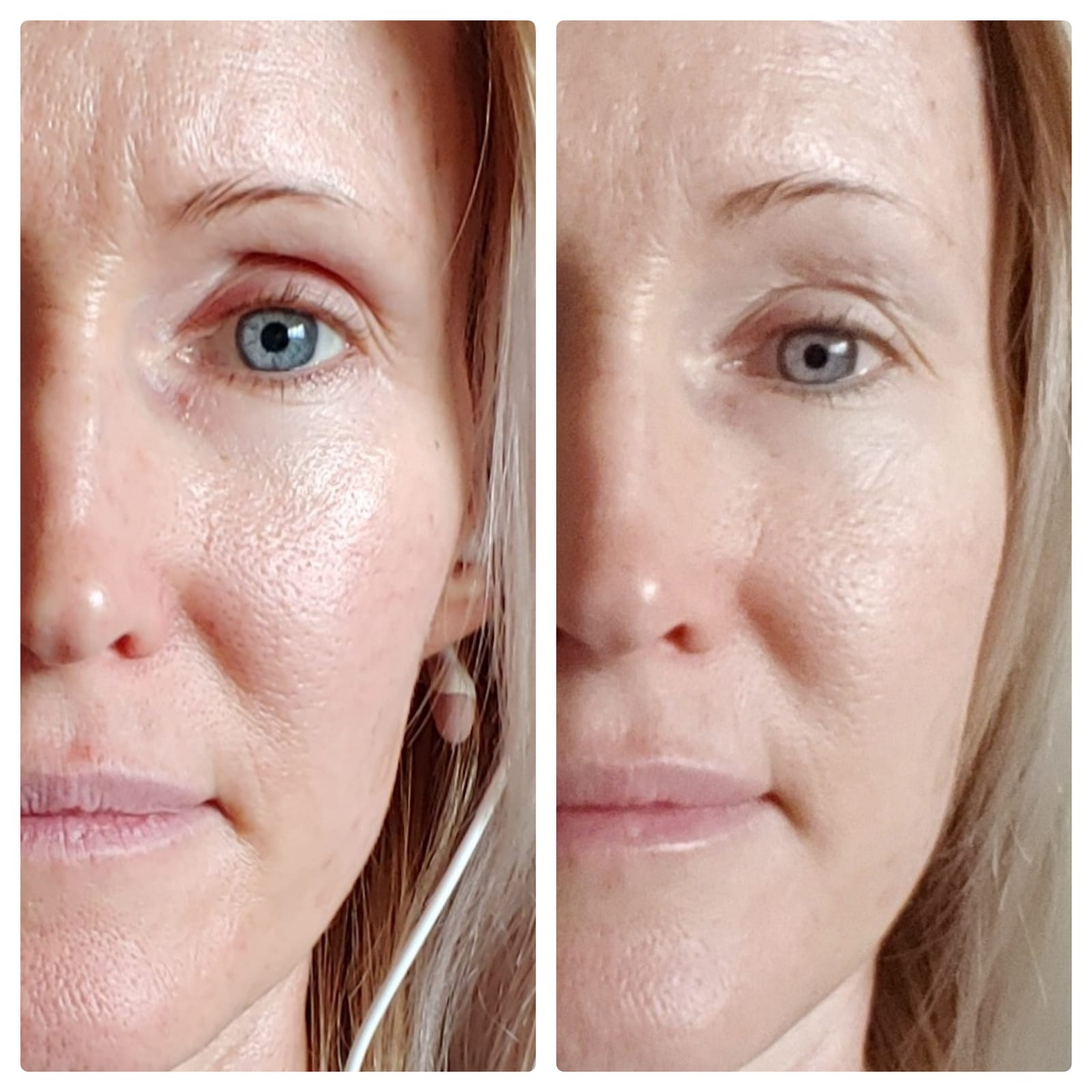 Project E Beauty Portable Rechargeable Galvanic Device | Skin Care Reduce Wrinkles Skin Tightening Firming Fine Lines Desincrustation Deep Pore Cleansing Rejuvenation Device customer photo 1