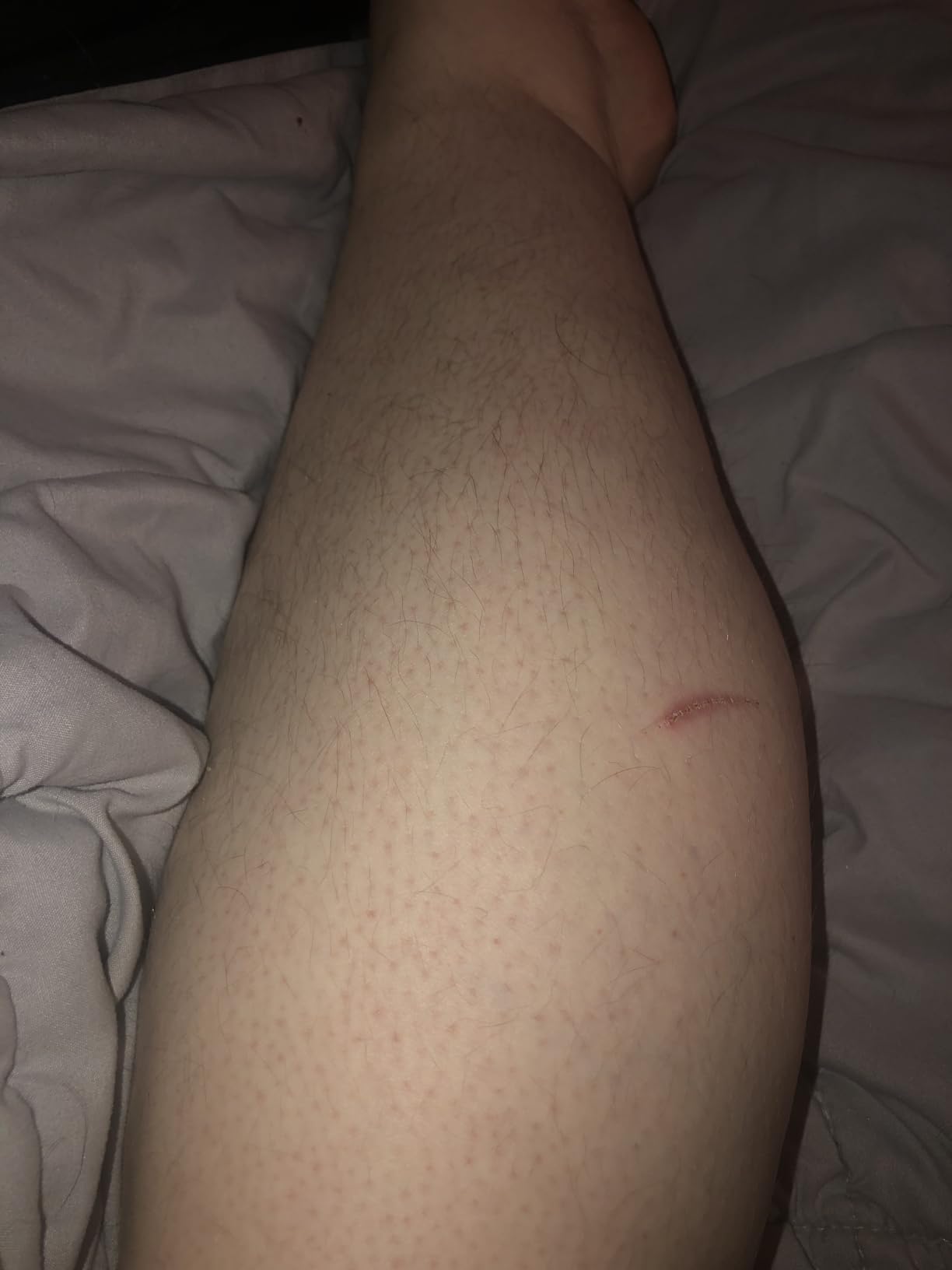 Philips SatinShave Essential Women’s Wet & Dry Electric Shaver for Legs & Body, Cordless, with Hypoallergenic Foil, HP6306/50 customer photo 2