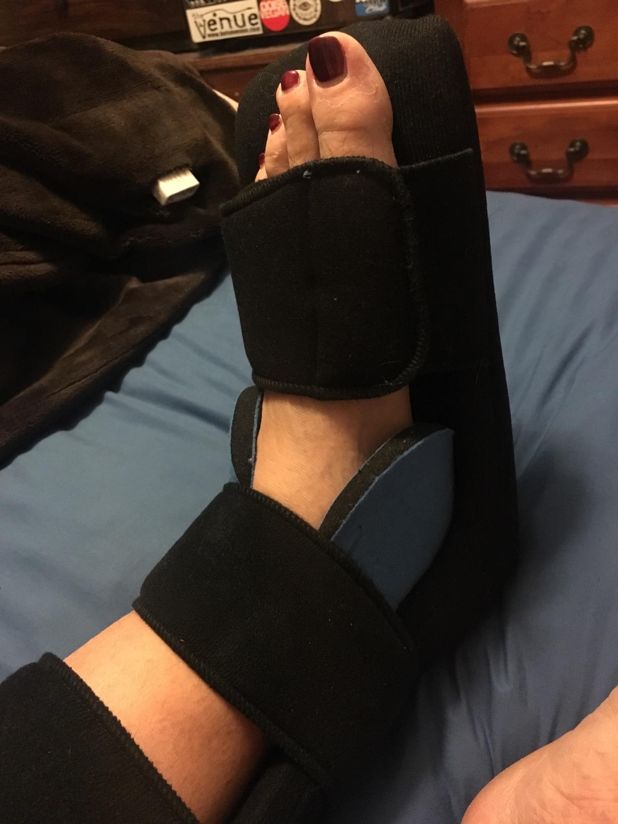 Vive Plantar Fasciitis Night Splint Plus Trigger Point Stretch Wedges customer photo 2