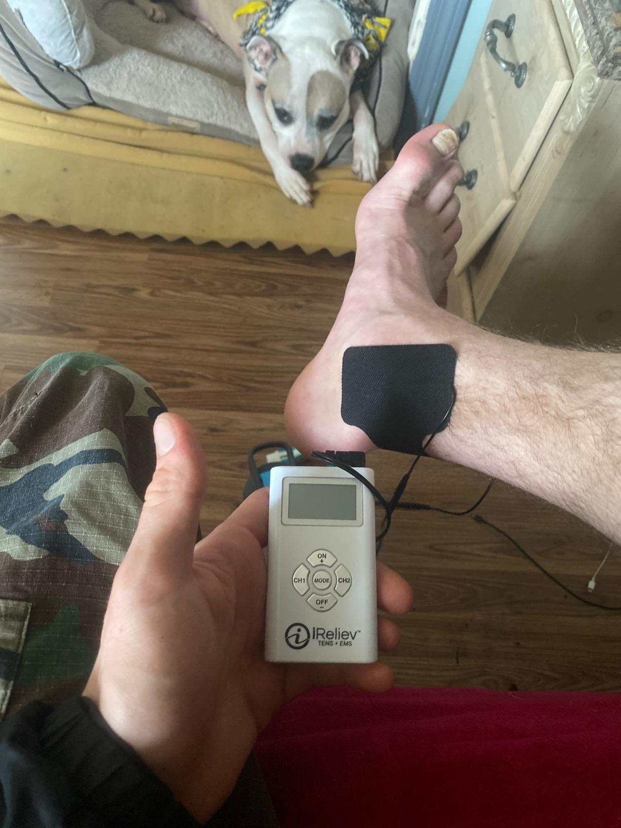 iReliev TENS + EMS Combination Unit Muscle Stimulator for Pain Relief, Arthritis, Muscle Strength - Treats Tired, Sore Muscles in Your Shoulders, Back, Ab's, Legs, Knee's, More customer photo 2