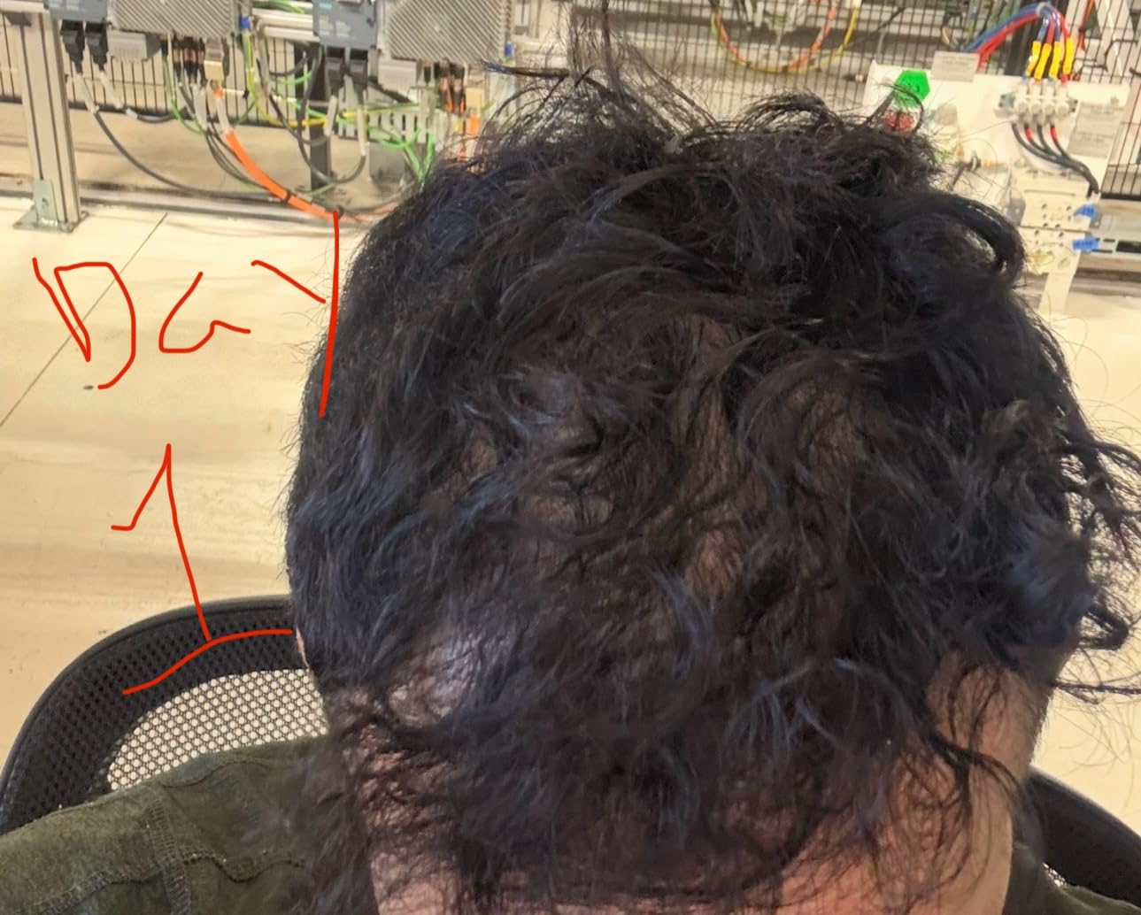 Nutricost Biotin (Vitamin B7) 10,000mcg (10mg), 240 Capsules, Quick Release customer photo 1