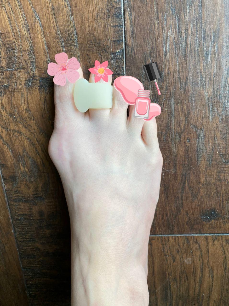 Bunion Corrector for Women and Men Bunion Relief Protector Sleeves Kit - Treat Pain in Hallux Valgus, Big Toe Joint, Hammer Toe, Toe Separators Spacers Straightener Splint customer photo 1