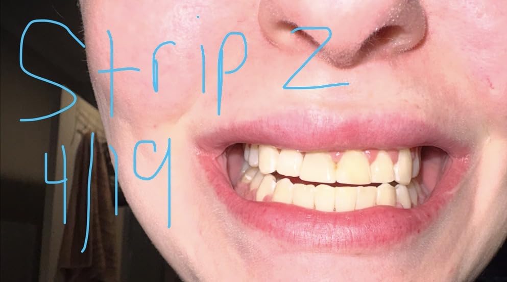 Crest Teeth Whitening Strips, Crest 3D Whitestrips Vivid Plus, Enamel Safe Teeth Whitening Kit, 12 Treatments (24 Strips), Visibly Whitens in Days, 8 Levels Whiter customer photo 1