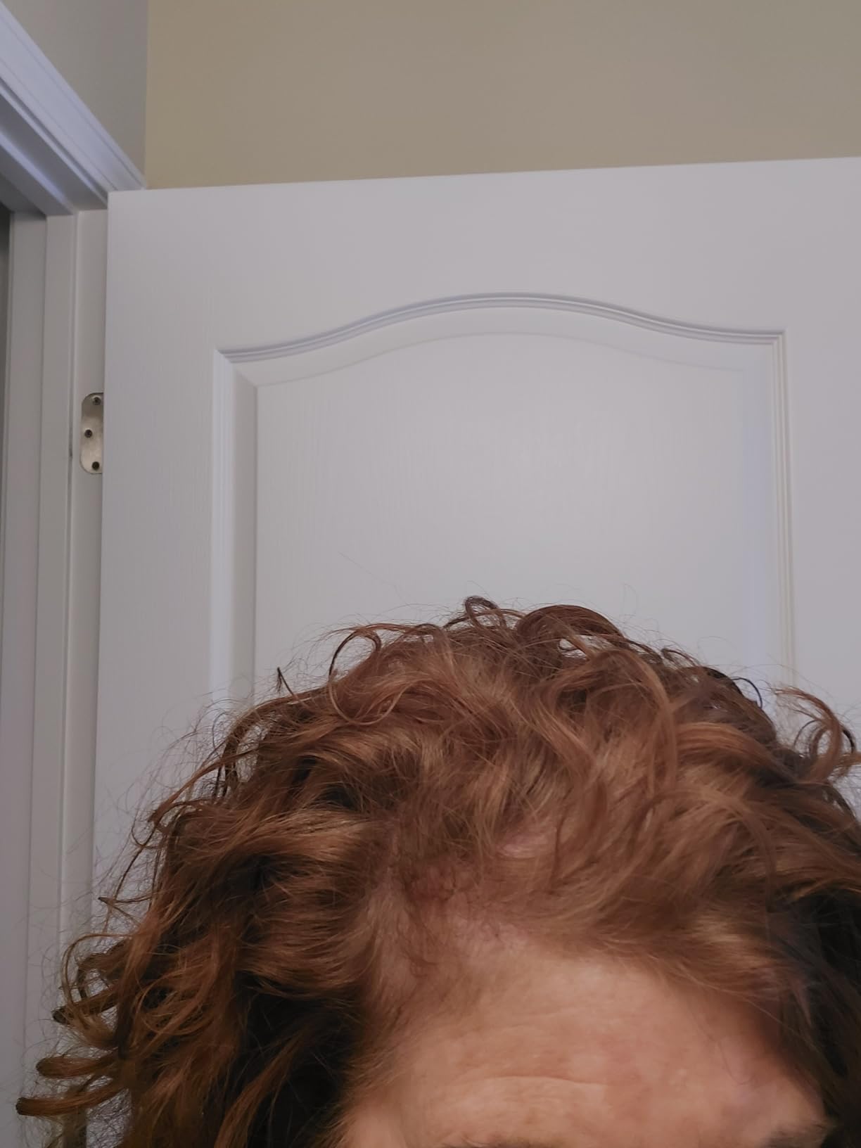 Nutrafol Women's Balance Hair Growth Supplements, Age 45+, 1-Month Bottle customer photo 1
