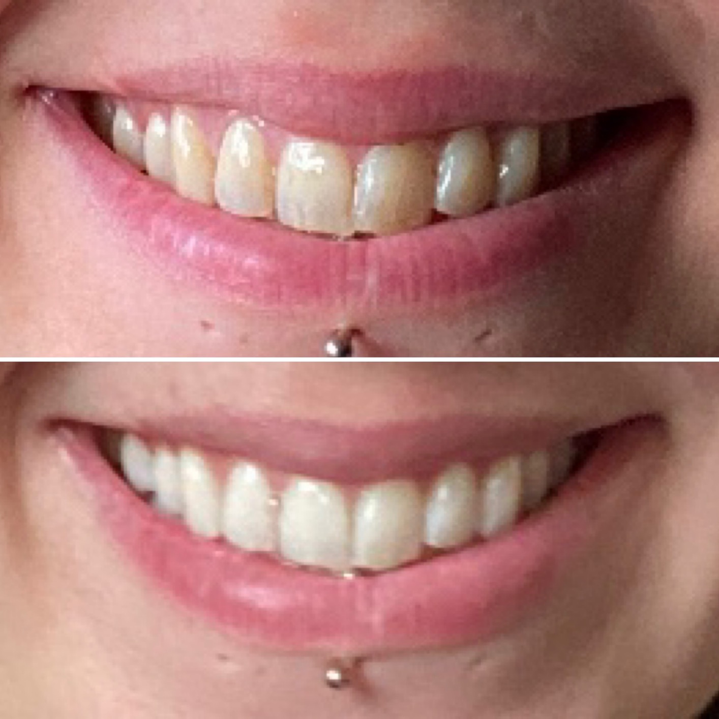 Crest Teeth Whitening Strips, Crest 3D Whitestrips 2 Week Smile Transformation, Enamel Safe Teeth Whitening Kit, 16 Treatments (32 Strips), Whiter Teeth in 2 Weeks, 11 Levels Whiter customer photo 1