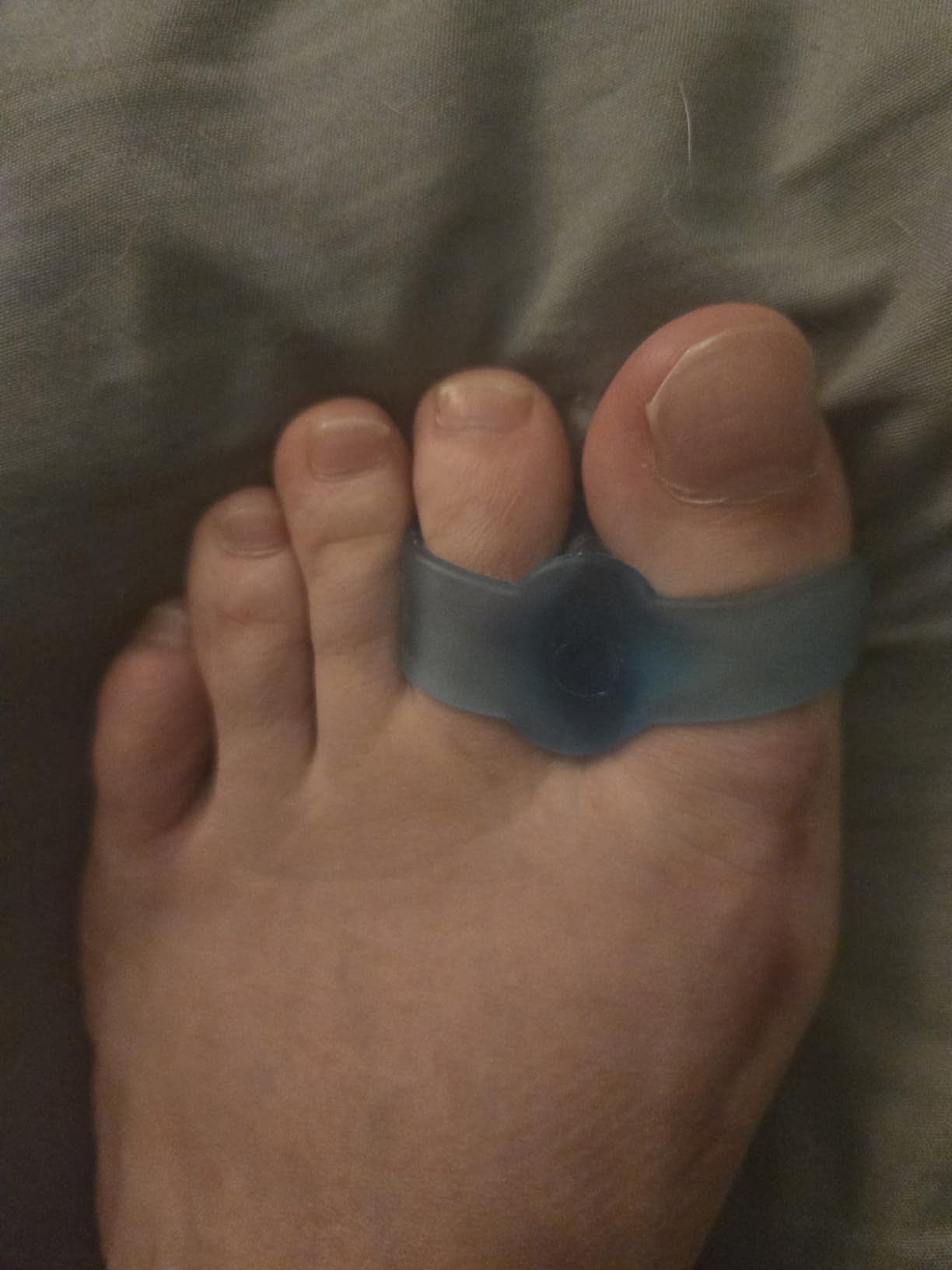 Welnove Pack of 12 Bunion Corrector, Toe Separators with 2 Loops, Big Toe Spacer Suitable for Bunion and Overlap Toe (White) customer photo 1