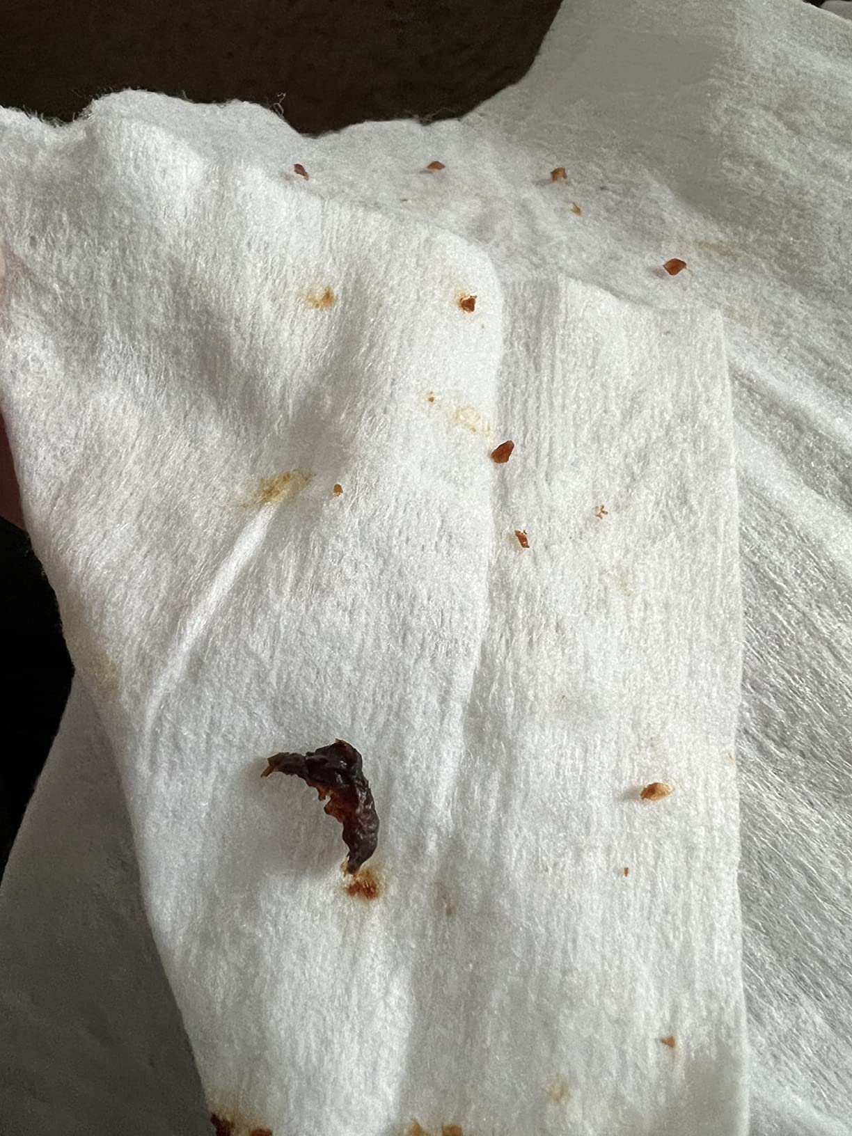 LEIPUT Ear Wax Removal - Ear Cleaner with 1080P Camera - FSA&HSA Black customer photo 1