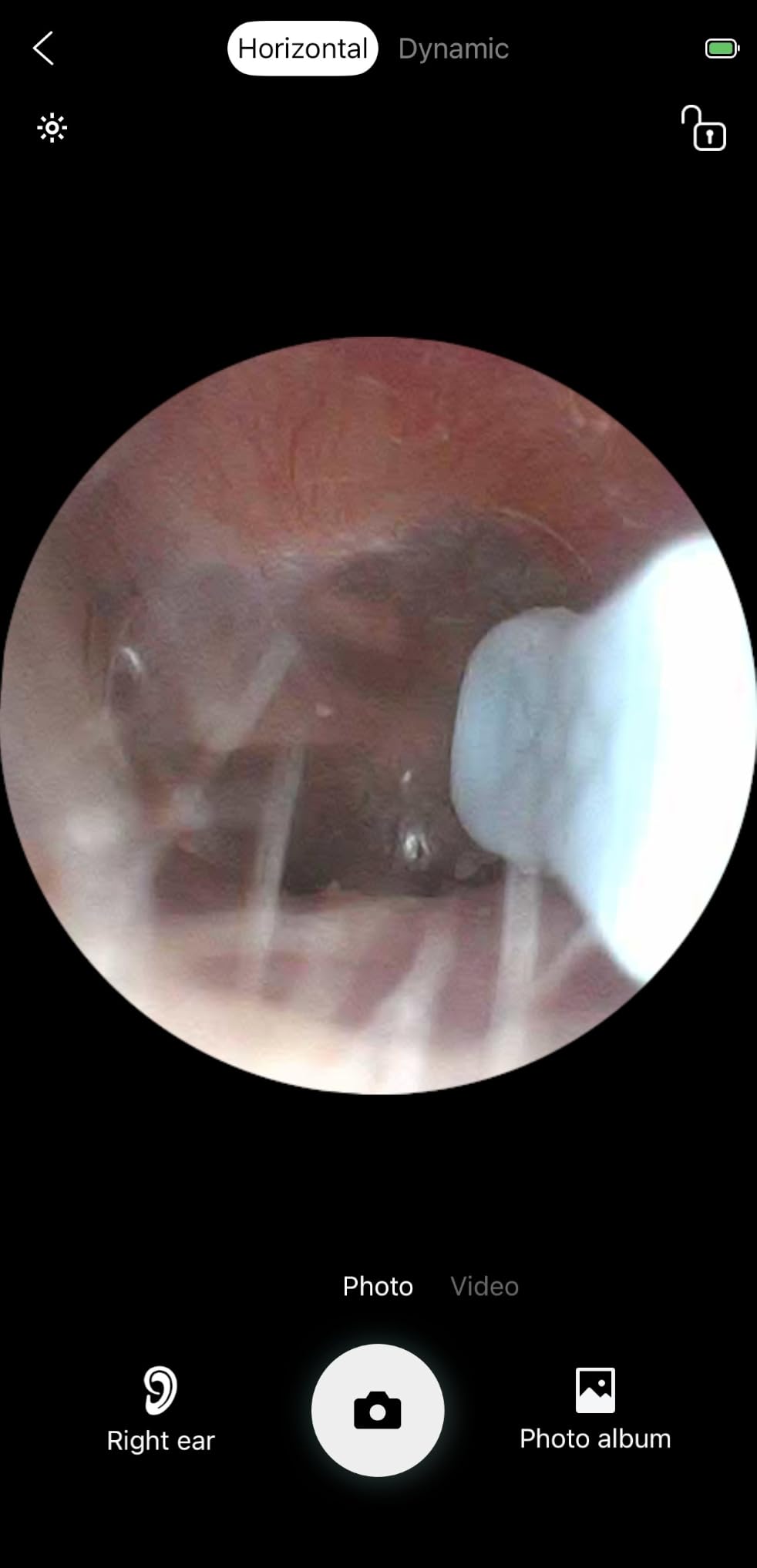 LEIPUT Ear Wax Removal - Ear Cleaner with 1080P Camera - FSA&HSA Black customer photo 2