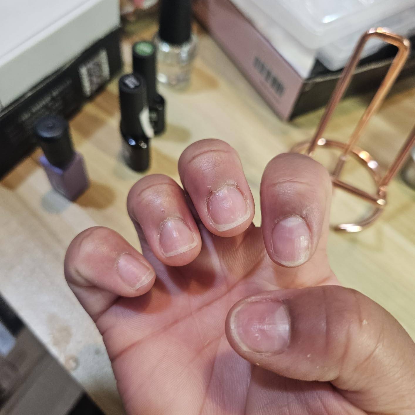 Biotin, Collagen, Hyaluronic Acid & Keratin - Hair Growth Support - 60 Caps customer photo 2