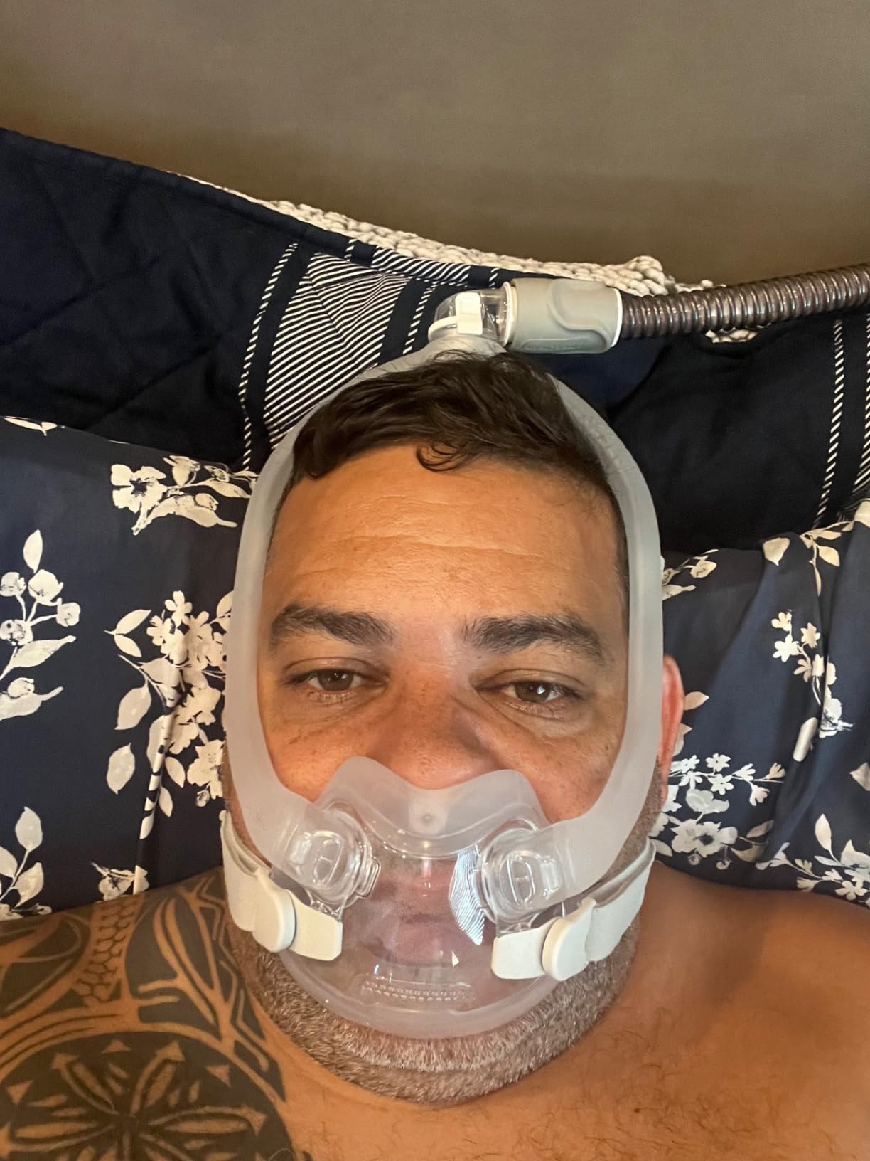 Resmed AirFit F30i Frame System Without Headgear, Stnd Frame, Wide Cushion customer photo 2