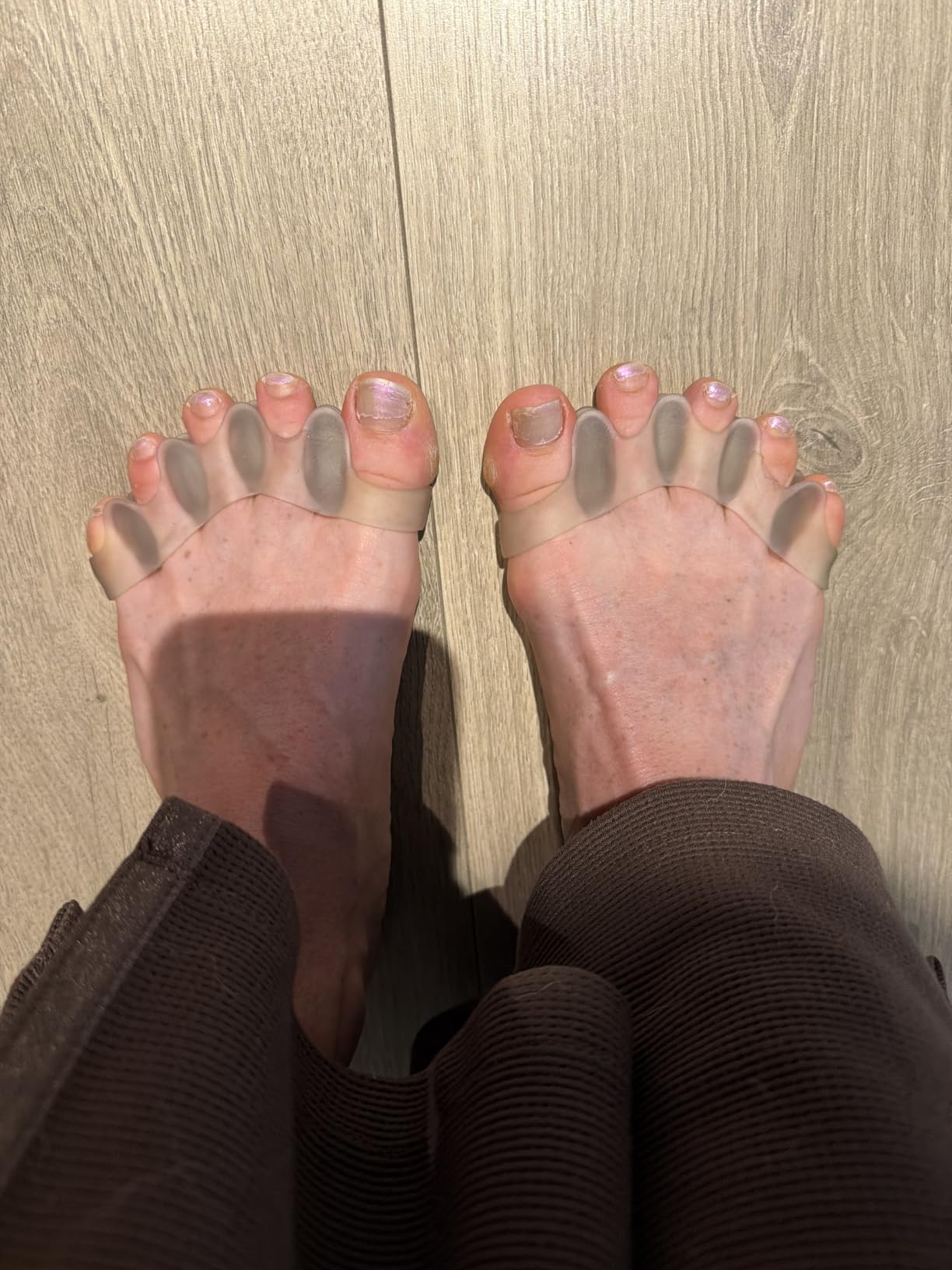 Mind Bodhi Toe Separators/Toe Spacers - Men & Women - Regular Size - Black customer photo 1