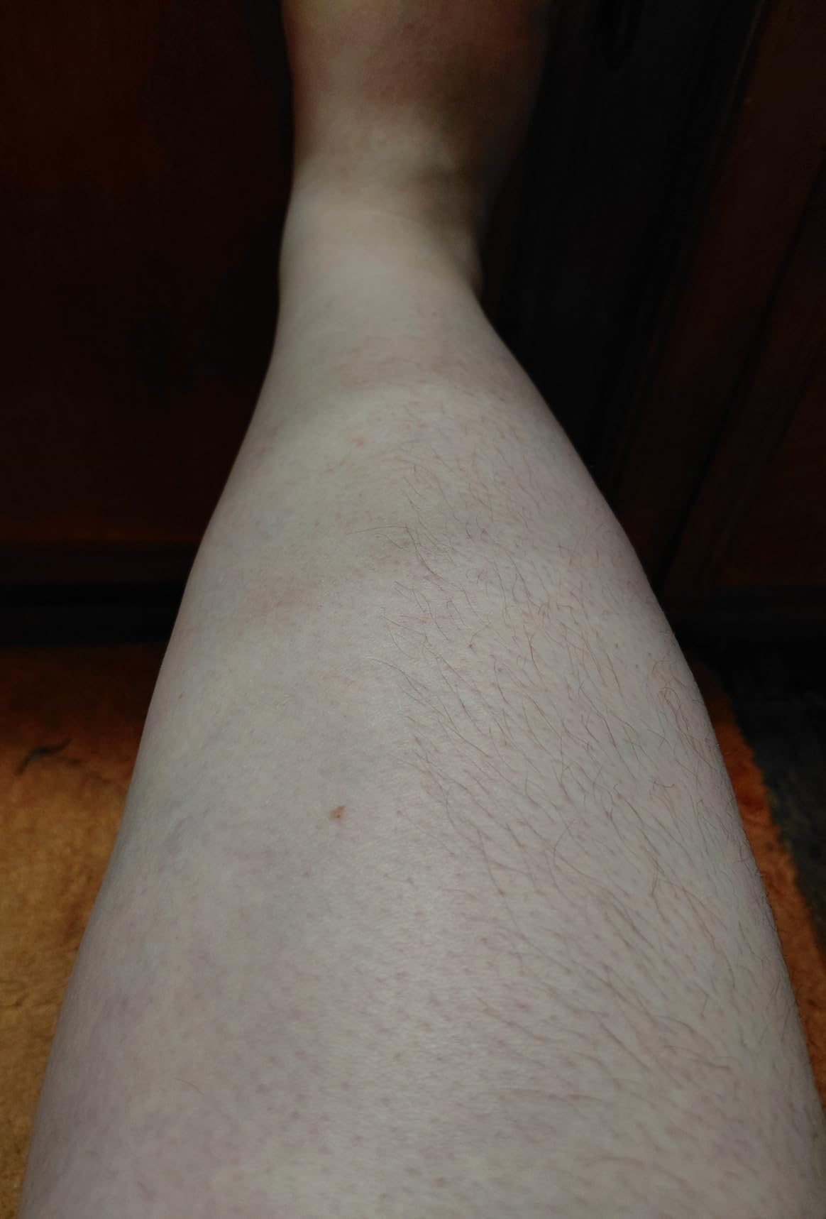 IPL Hair Removal Device for Women and Men at Home customer photo 1