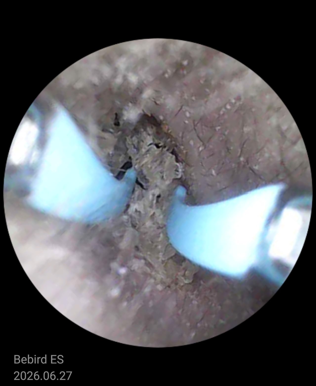 Bebird R37R Ear Wax Removal Tool Camera, Flexible Scope and Visual Tweezers customer photo 2