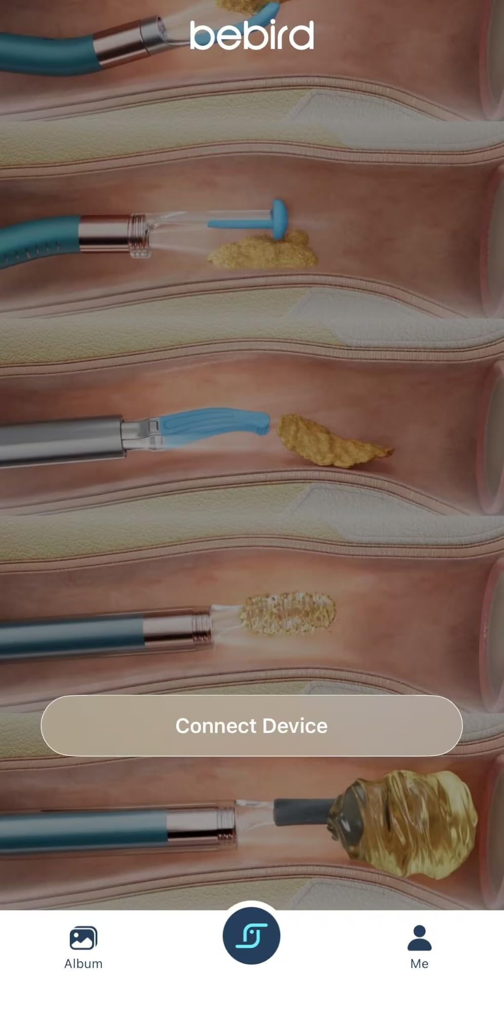 Bebird D39R Ear Wax Removal:Ear Camera with Storage Case &Painless Tweezers customer photo 1