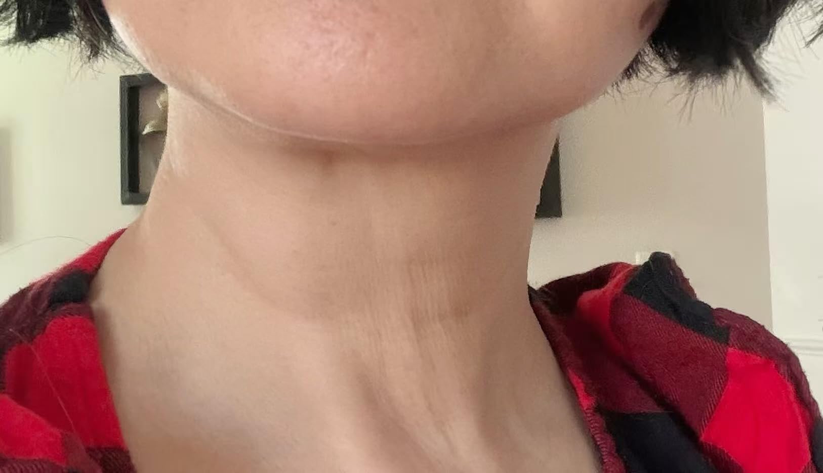 7-in-1 Microcurrent Facial Device, Red Light Face & Neck Massager customer photo 1