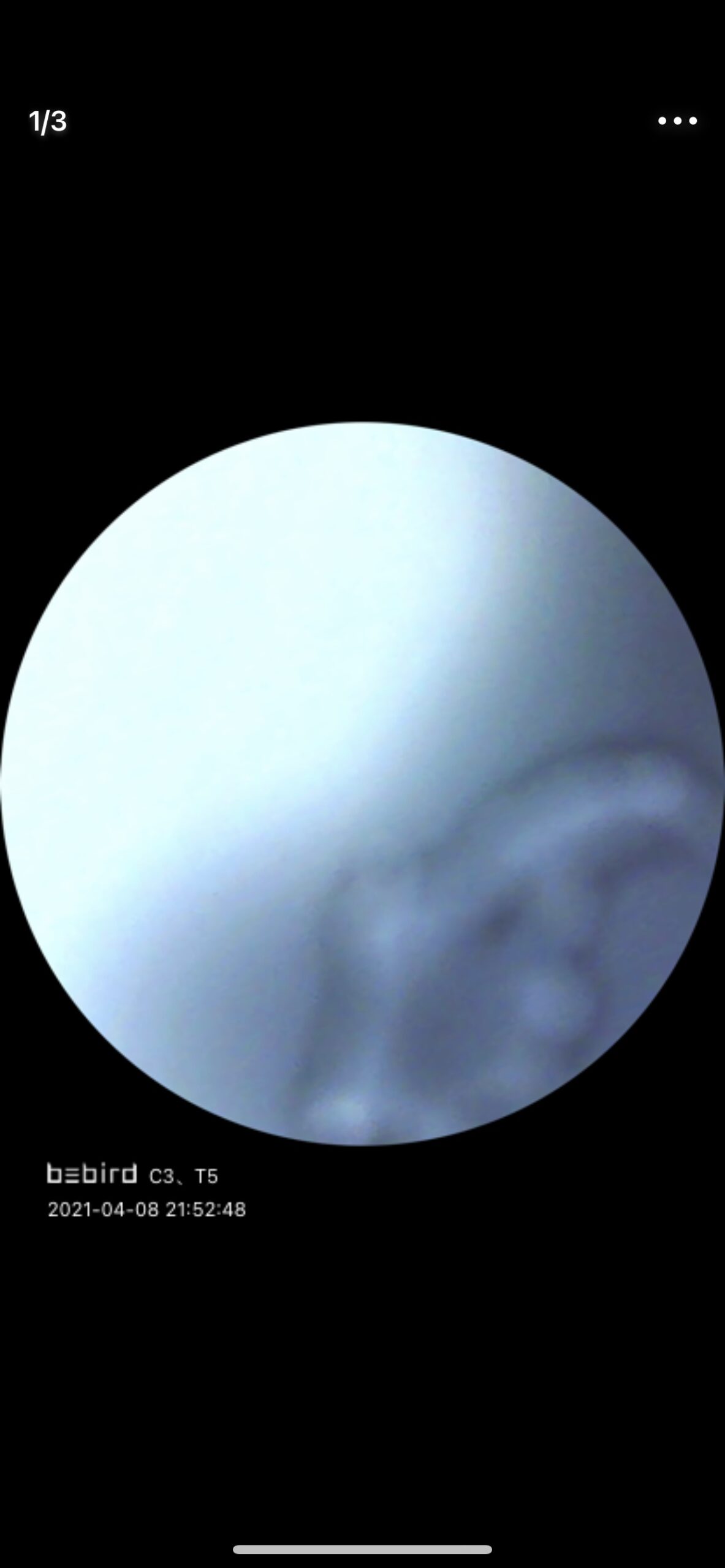 BEBIRD R1 Ultra Ear Wax Removal Tweezers: 1296P HD Ear Camera Cleaner IP67 customer photo 2