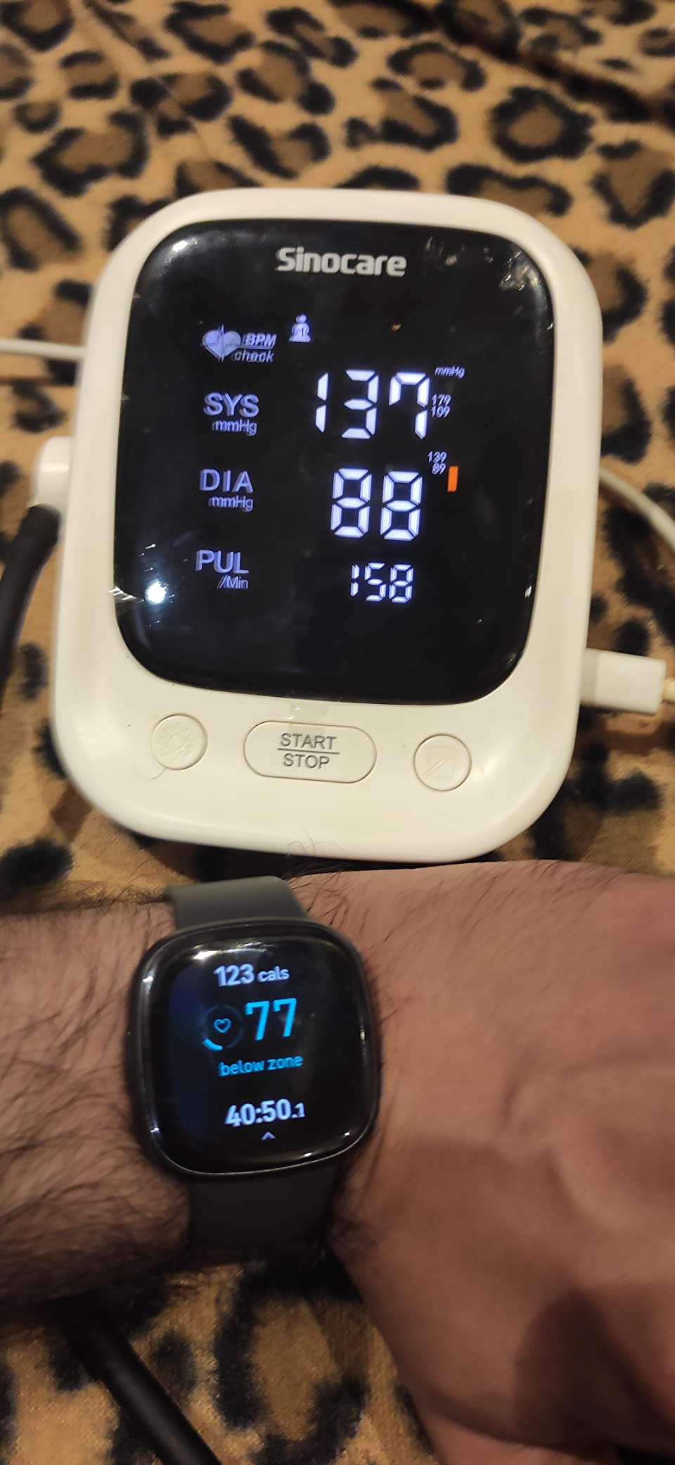 Fitbit Sense 2 Health and Fitness Smartwatch - Shadow Grey/Graphite customer photo 2
